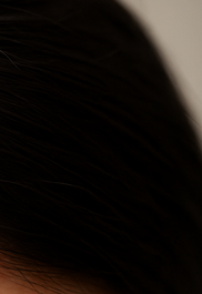 건선 피부염 완전정리