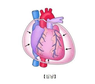 심낭사진