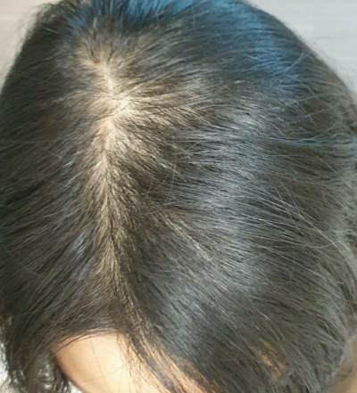 씨퓨리 닥터33 탈모 앰플 내돈내산 효과