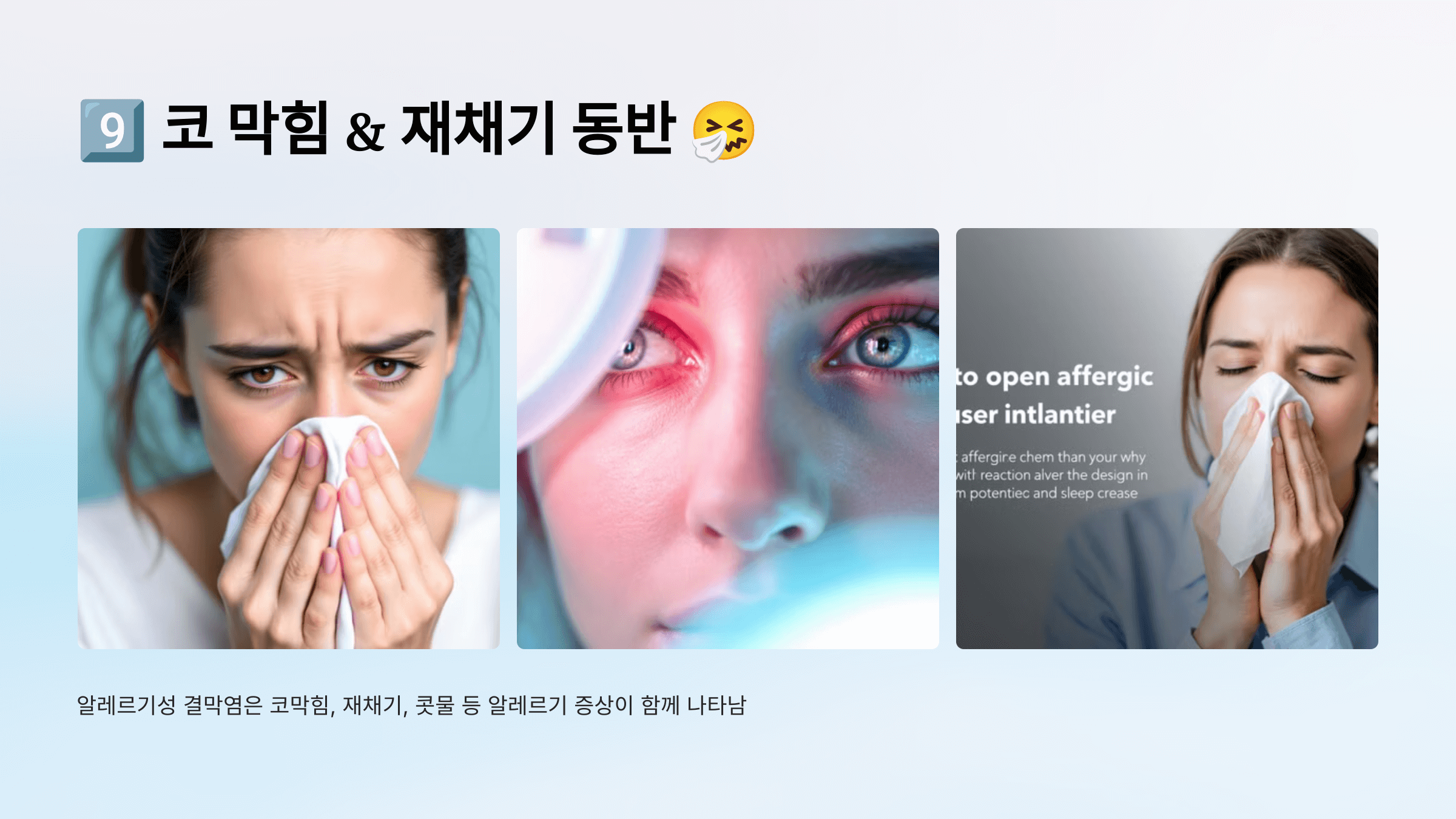 결막염과 관련된 사진입니다.