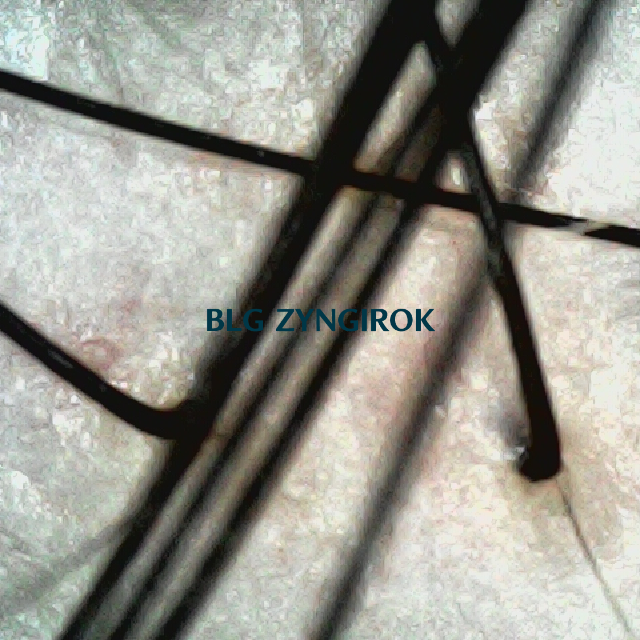 뒷머리 두피사진 모습이다.