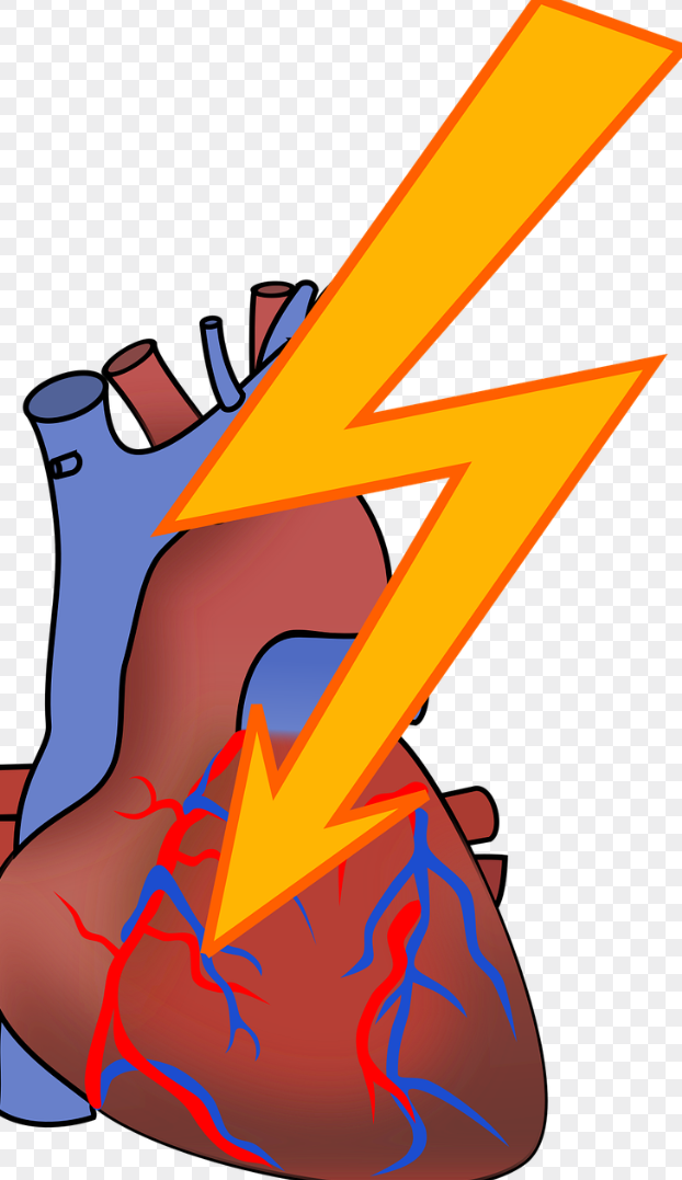 심부정맥혈전증과 관련된 사진