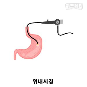 위저선 용종