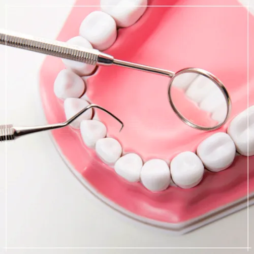 지르코니아 임플란트: 특징&amp;#44; 비용&amp;#44; 수명2