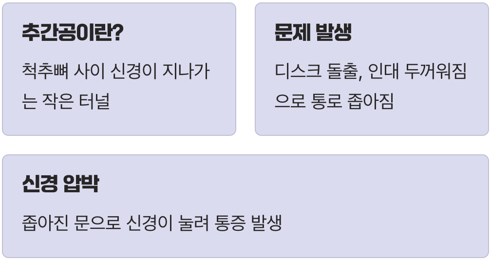 신경이 지나가는 &amp;#39;작은 문&amp;#39;&amp;#44; 추간공