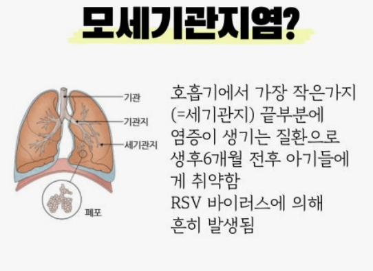 급성 기관지염 증상 관리법