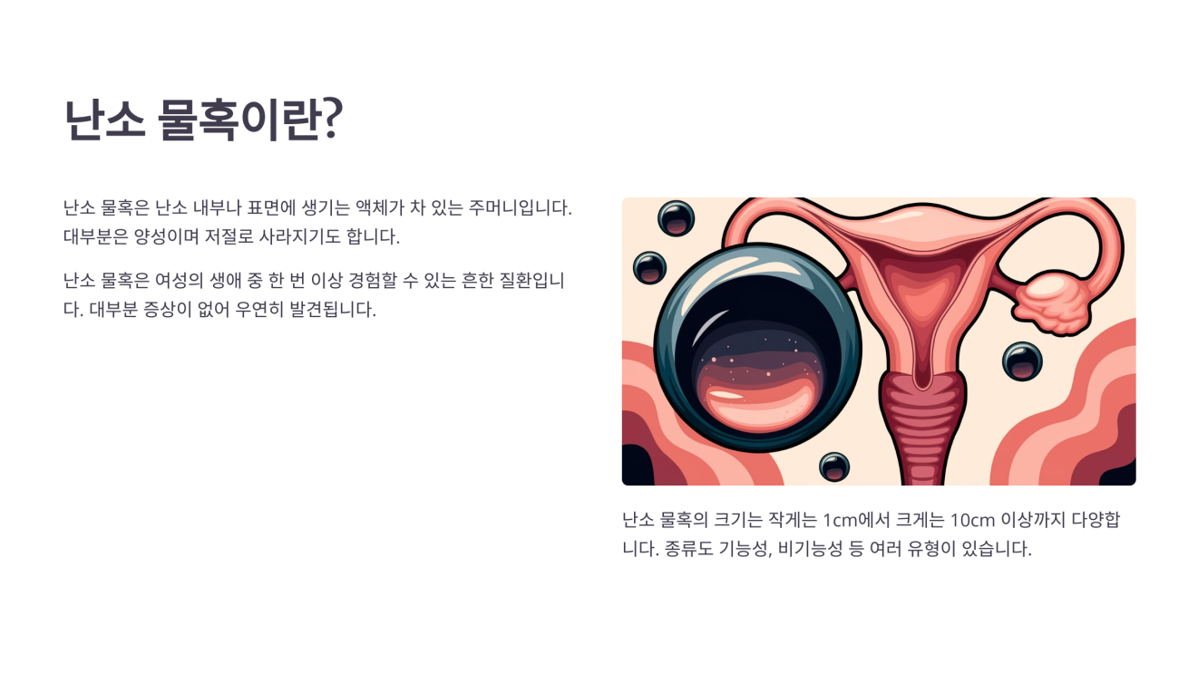 난소 물혹 2