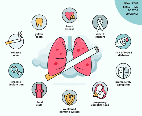 폐암 주요원인 담배 호흡기 질환 수명 감소