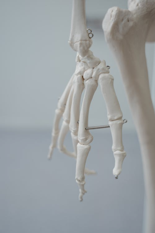 관절에 좋은 음식 총정리