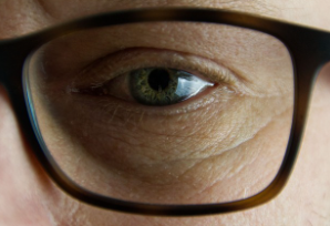 황반변성 증상 치료법 자가진단 원인