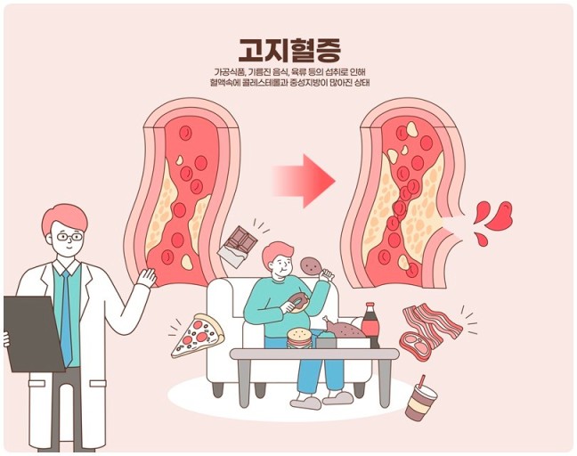 고지혈증 이미지