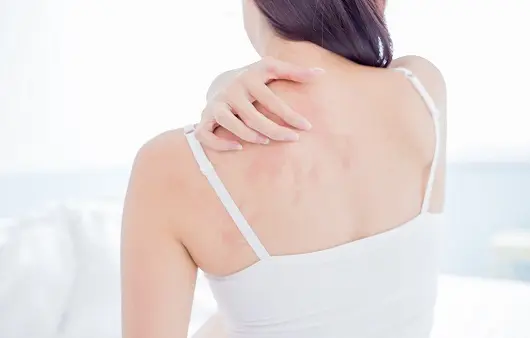 피부가려움증 원인&amp;#44; 12가지 원인 알아보기