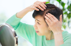 여성에게 많은 탈모