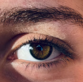 황반변성 치료법 자가진단 방법 합병증