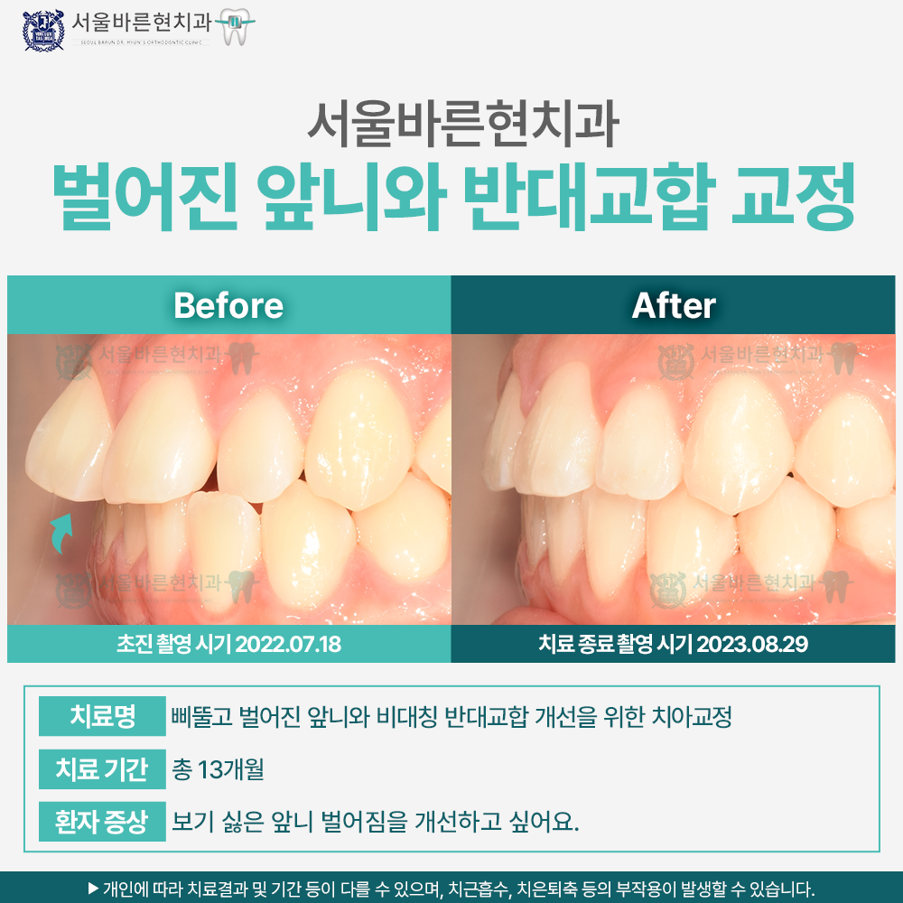 부산교정치과