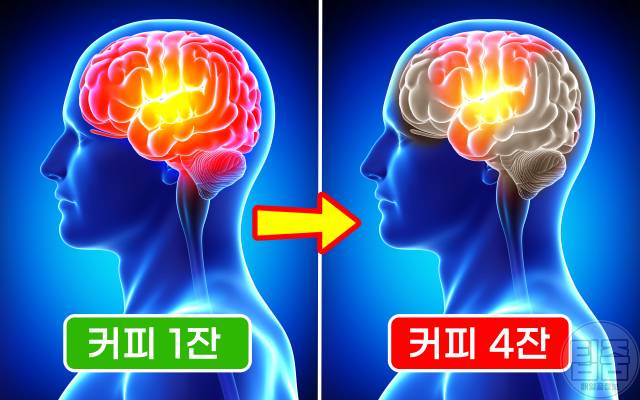 커피 많이 마시면 커피과다복용 부작용 뇌혈류감소 두통