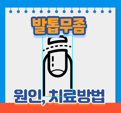 발톱무좀 치료방법