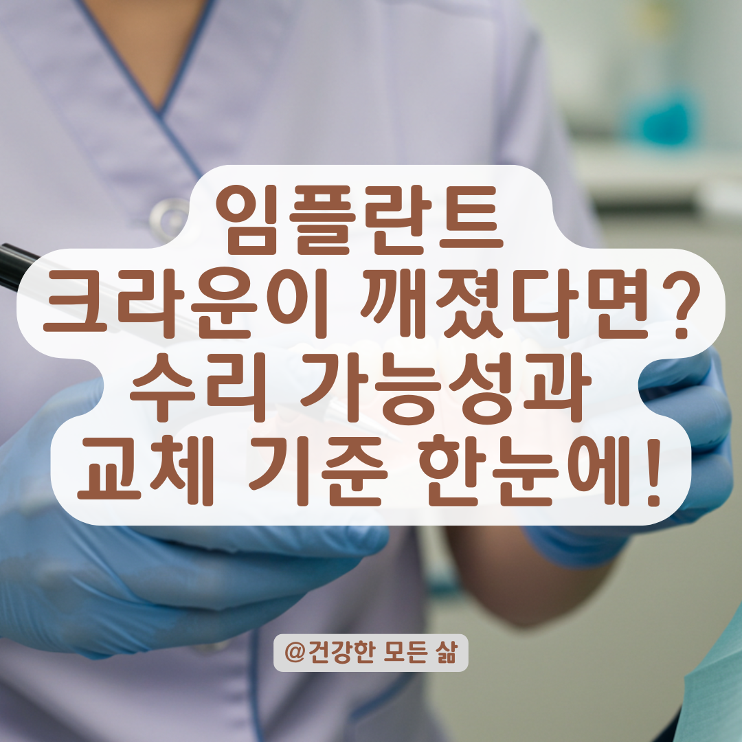임플란트 크라운 파손 유형별 수리 가능성과 교체 기준 정리.