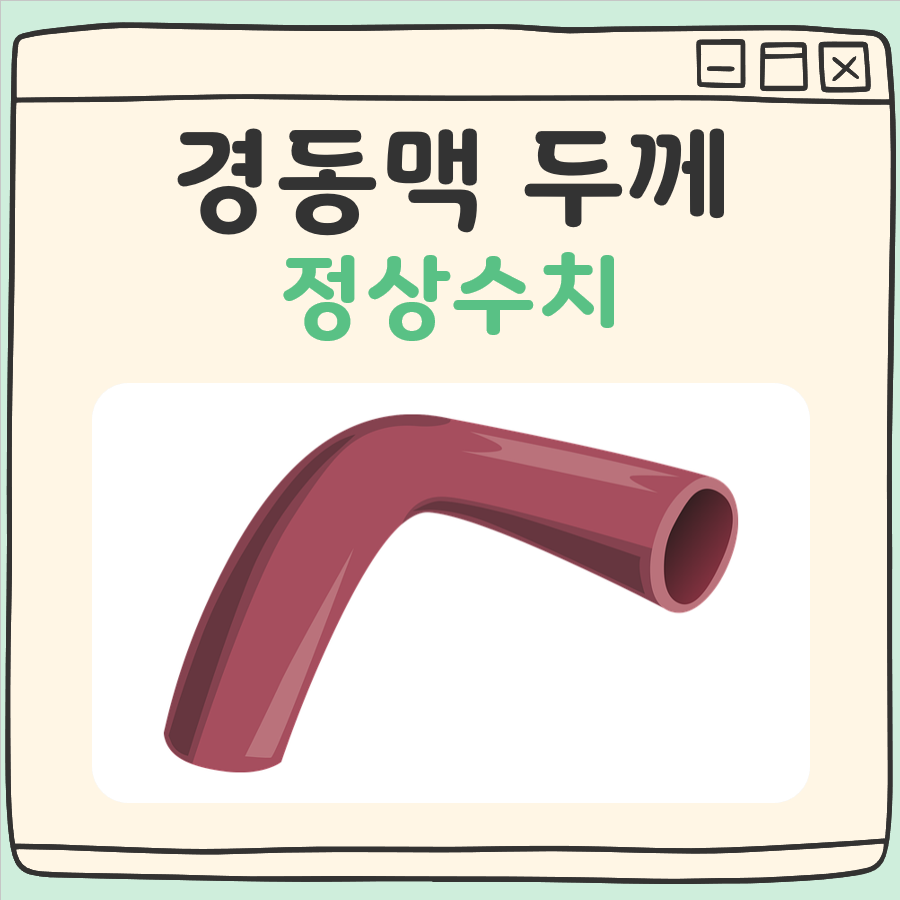 경동맥 두께 정상수치