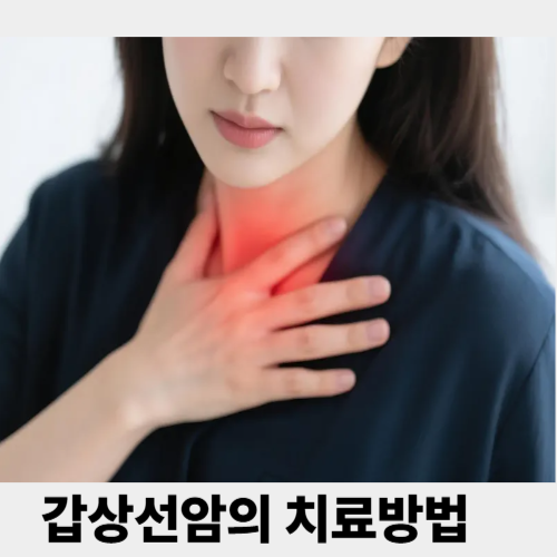 갑상선암