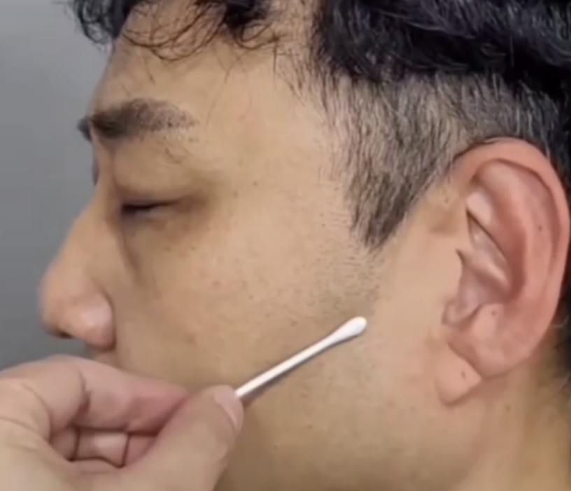 김수용 프랭크 징후