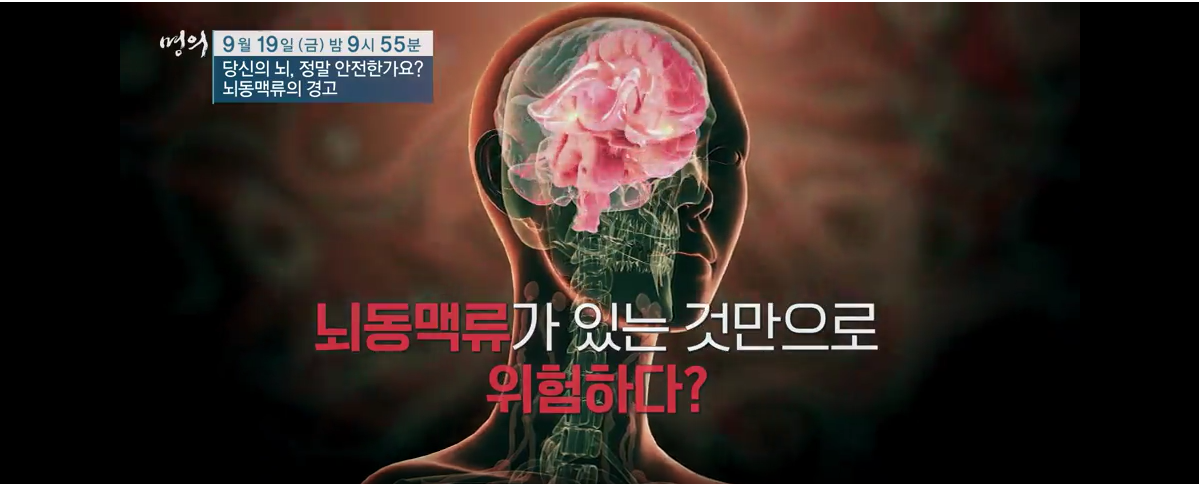 명의/ 당신의 뇌&amp;#44; 정말 안전한가요? - 뇌동맥류의 경고