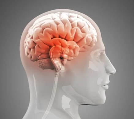 두통의 원인과 종류 치료 방법