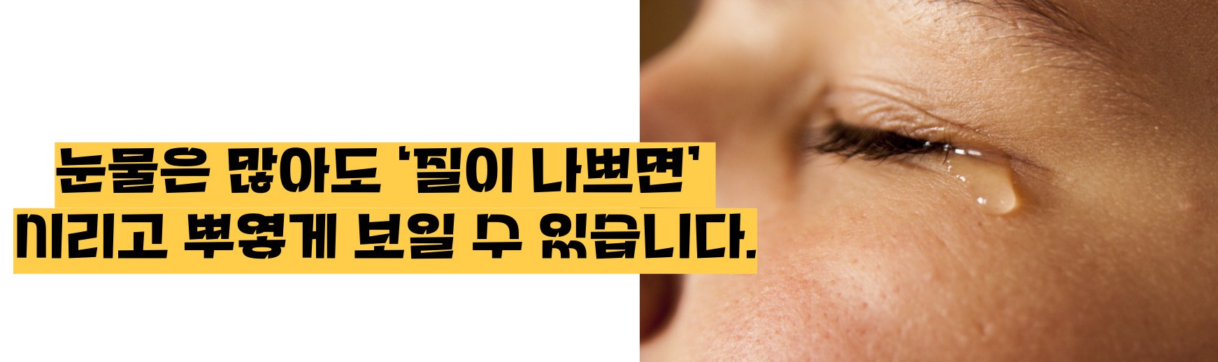 눈이 시리고 눈물이 나는 이유