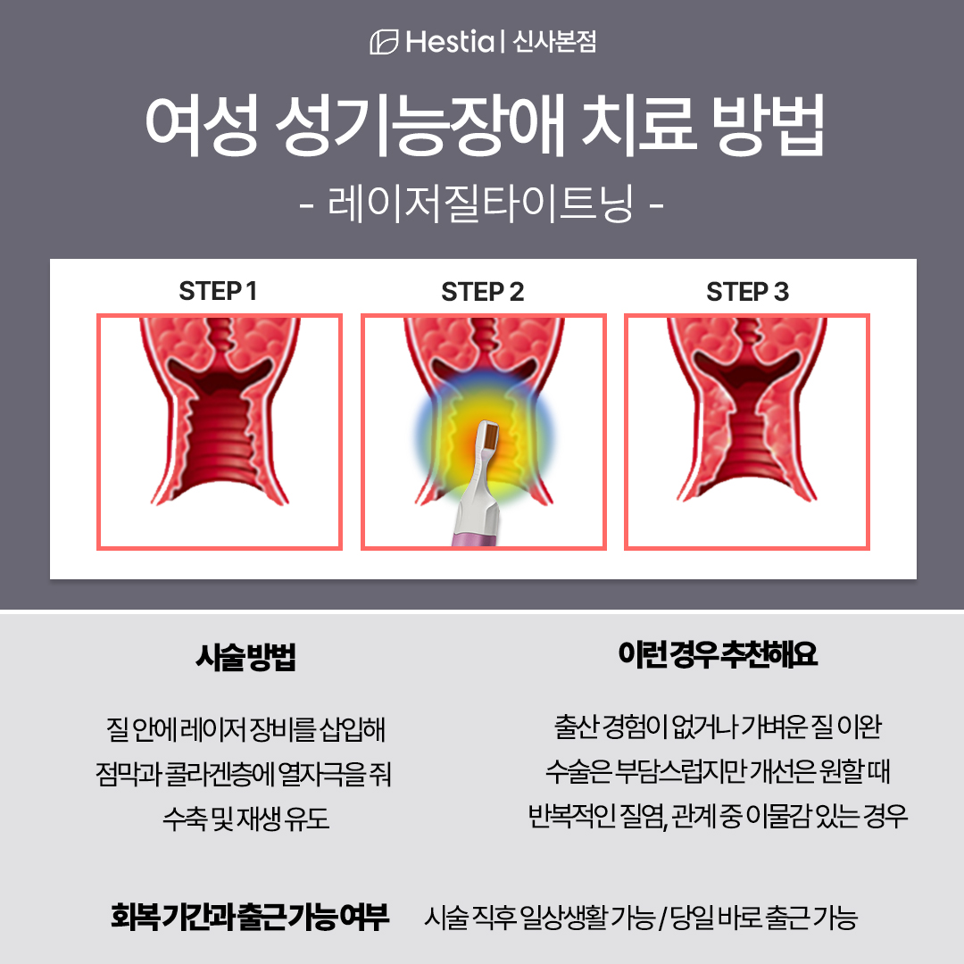 여성 성기능장애 치료 방법 -레이저질타이트닝-