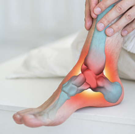 발바닥통증의 원인 30