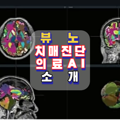뷰노-치매진단-의료AI-미FDA승인-소개