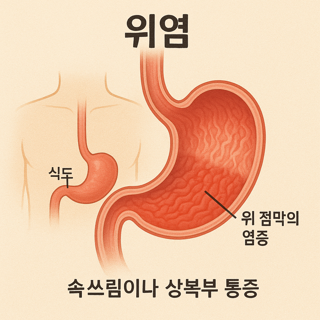 당신이 꼭 알아야 할 '위염'의 모든 것