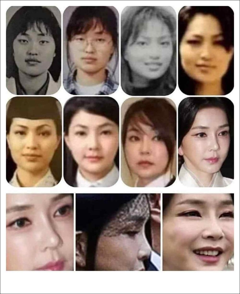 김건희 실제나이 어릴적사진 성형전 (+ 반클리프목걸이가격)