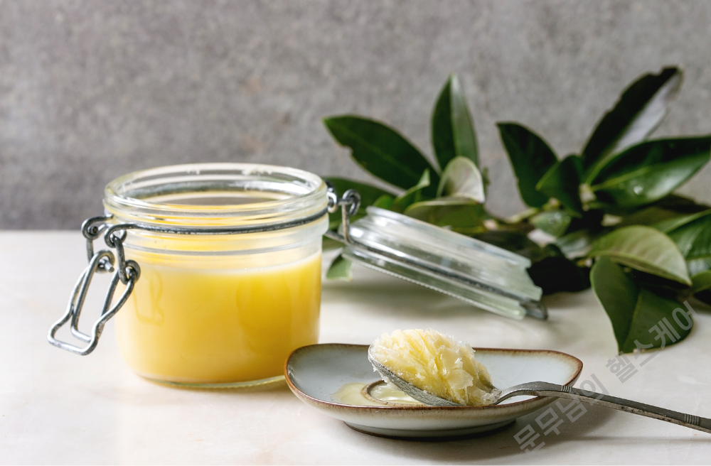 앵커 버터(Anchor butter)