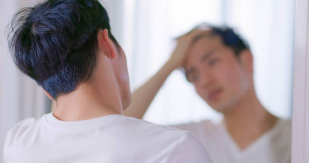 탈모 예방 방법 치료 에 좋은 음식 약 남성형 여성형 휴지기 반흔성 안드로겐 성 테스토스테론 호르몬 견인성 원형 자가면역 질환 영양제 비오틴