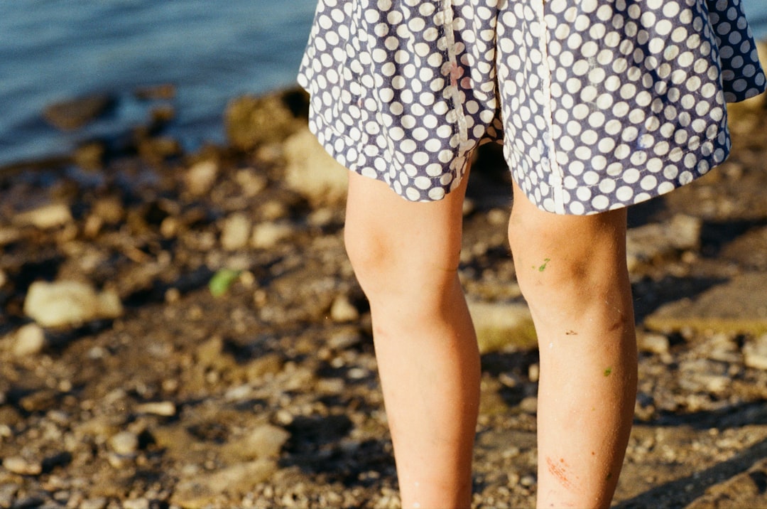 Knee