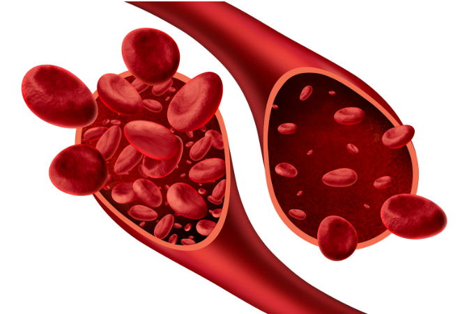빈혈 예방의 핵심(음식)