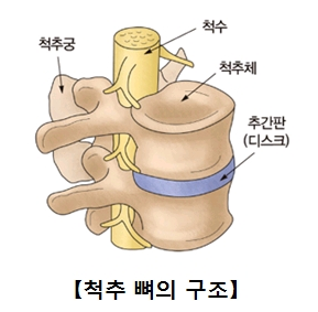 허리디스크 증세