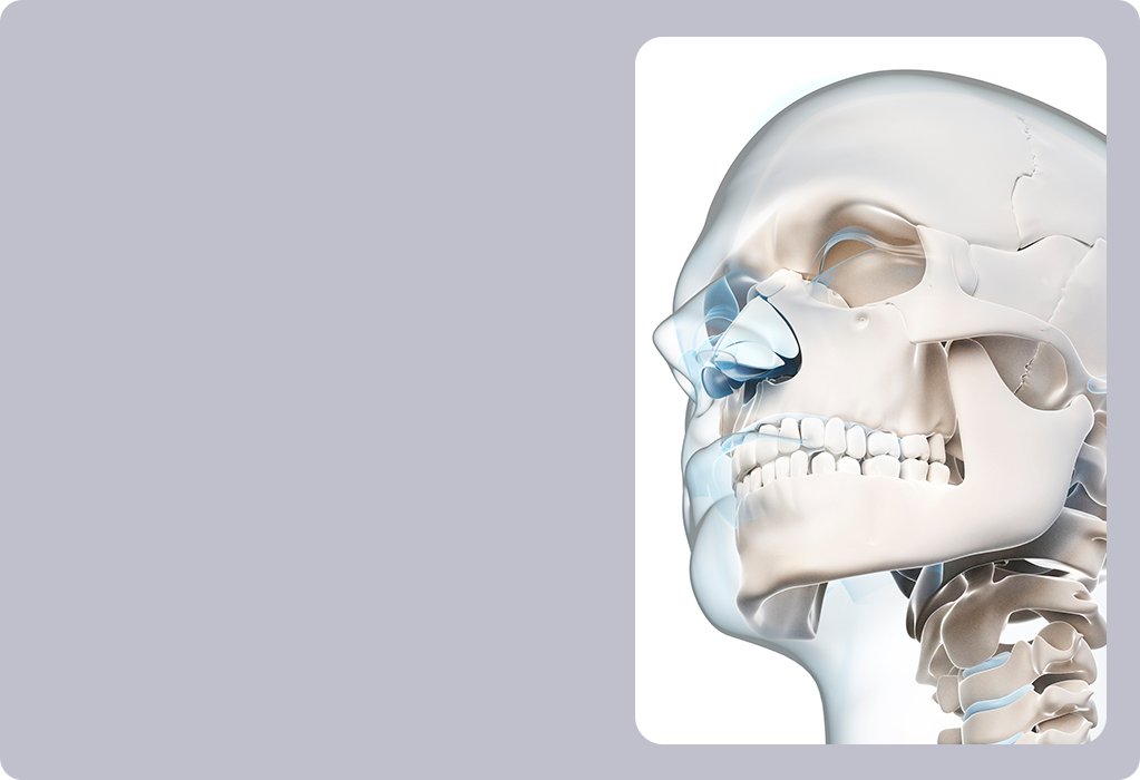 옆광대축소주사