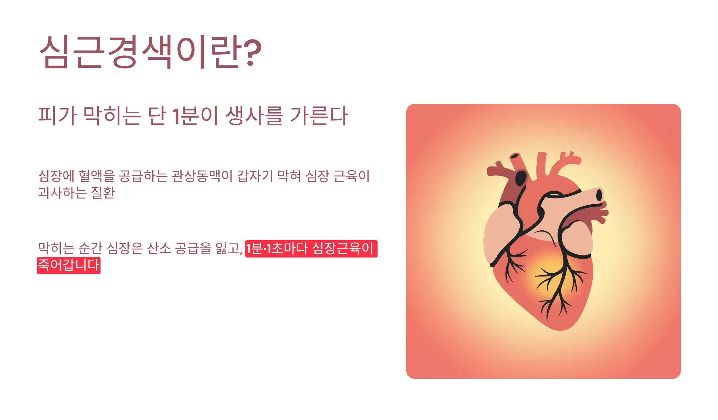 심근경색 초기증상은 이렇게 시작된다