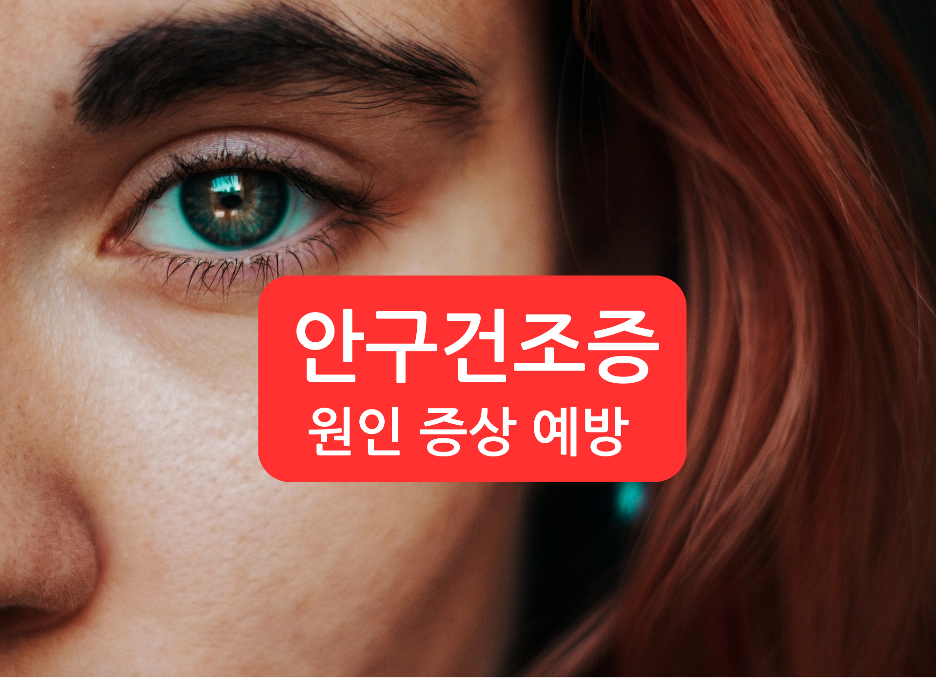 안구건조증