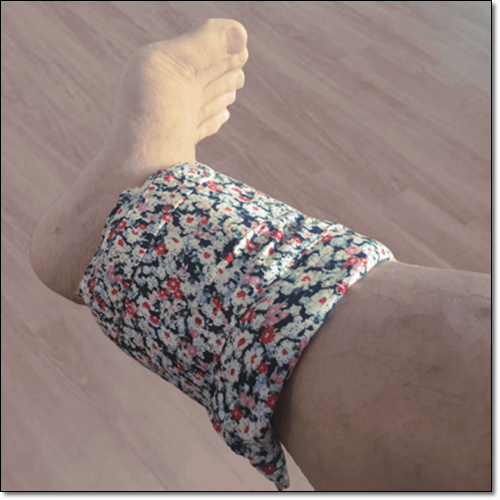 아킬레스건염 가정요법