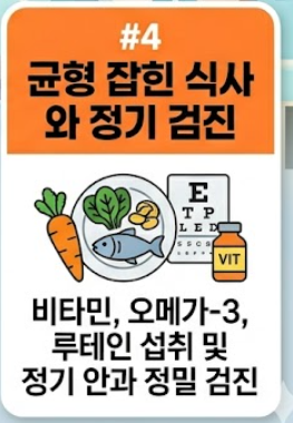 백내장 수술후 주의사항