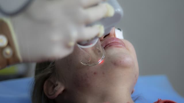 모낭염-여드름-피부과-치료