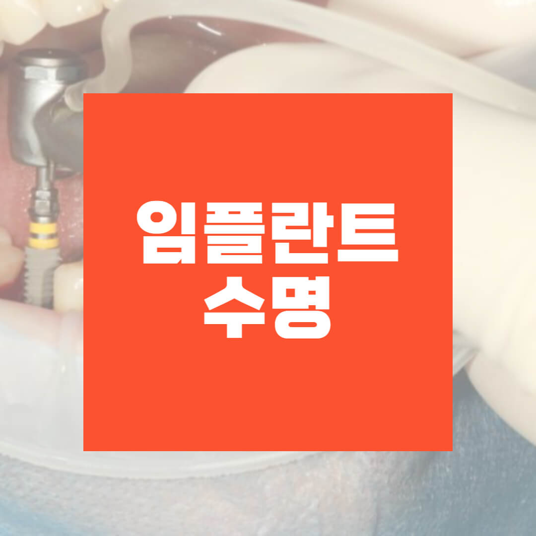 임플란트 수명