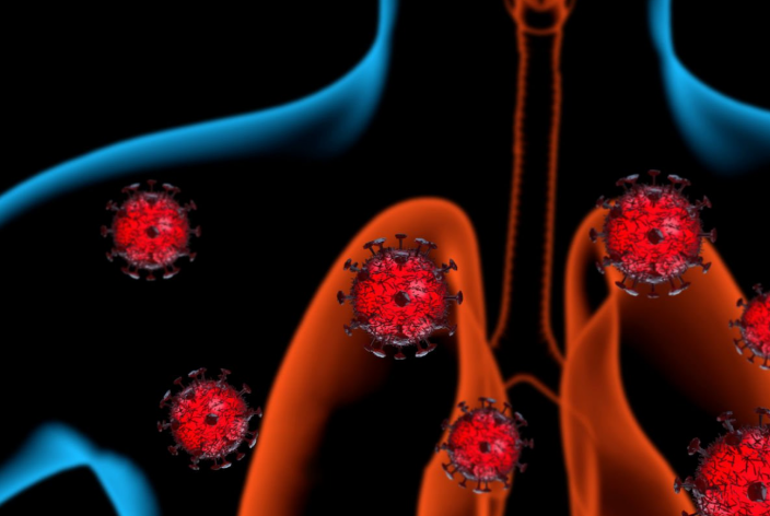 폐렴 초기 증상과 예방법 및 폐렴에 좋은 음식