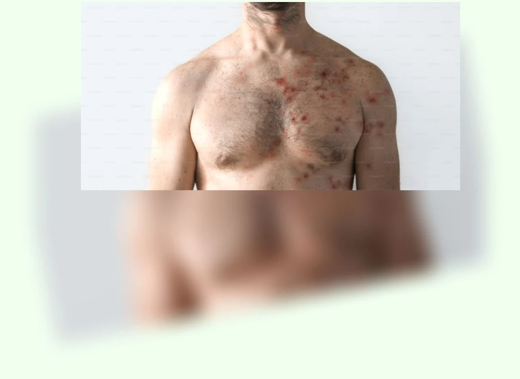 알레르기 비염 관리_2_subsection