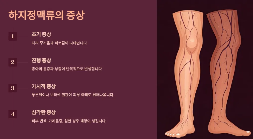하지정맥류-증상