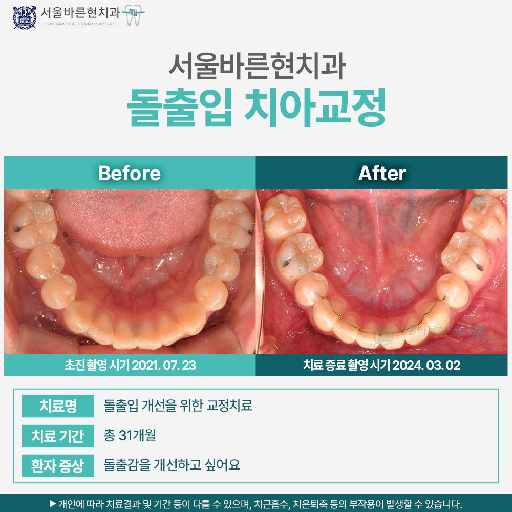 해운대치아교정