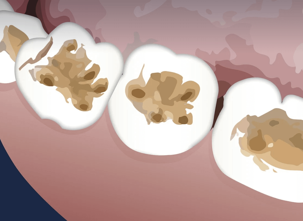 기능성 치약 가이드: 고체치약, 미백치약, 센서티브 치약 외.